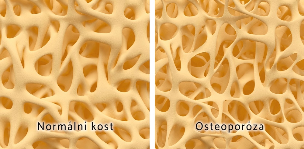 Nároky na výživu kostí během života